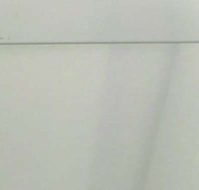 Necropsy Type 316 Stainless - OO047