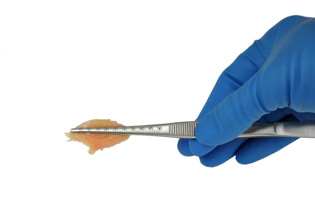 Dissection Forceps with Optional Imprinted Ruler - AB090