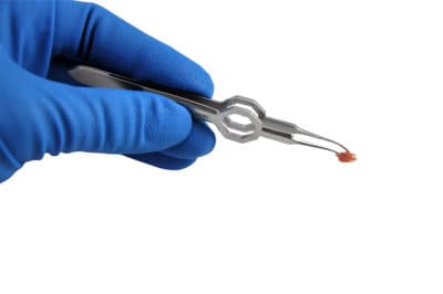 Forceps, Micro Serrated Tissue - Image 2