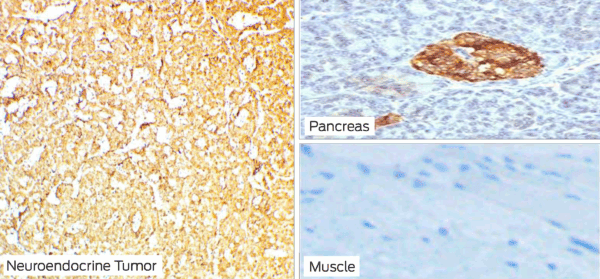 Control Slides, IHC, CHROMOGRANIN A, Box of 100 - Image 2