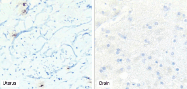 Control Slides, IHC, Tryptase, Box of 25 - Image 2