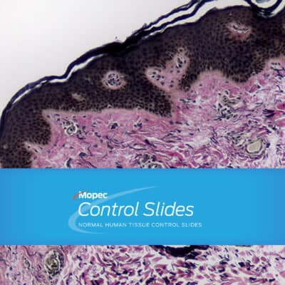 Normal Human Tissue Control Slides