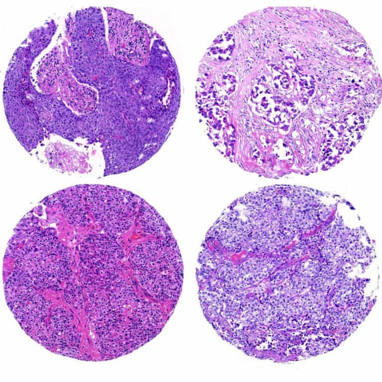 Control Slides, Tissue Microarray, Normal Human Tissue, 4 Tissue Types, Chosen From 15 Tissue Types, Box of 25