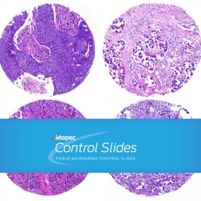 Tissue Microarray Control Slides